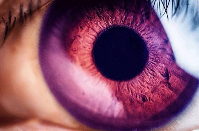¿Sabías que el color de ojos morado es uno de los tonos más escasos y fascinantes que existen?