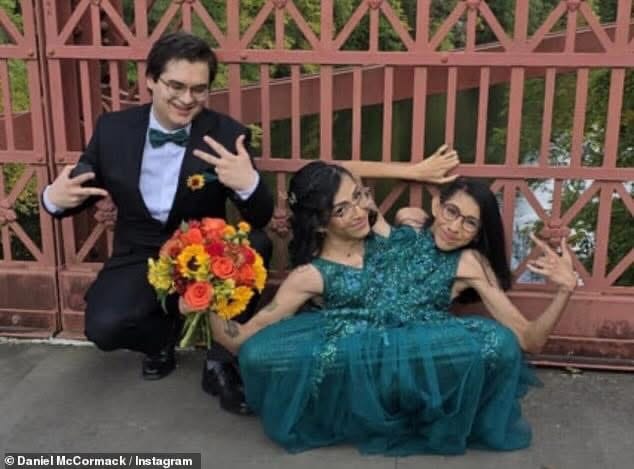 Carmen Andrade, una de las gemelas unidas, se casa con su viejo novio en una emotiva ceremonia de boda